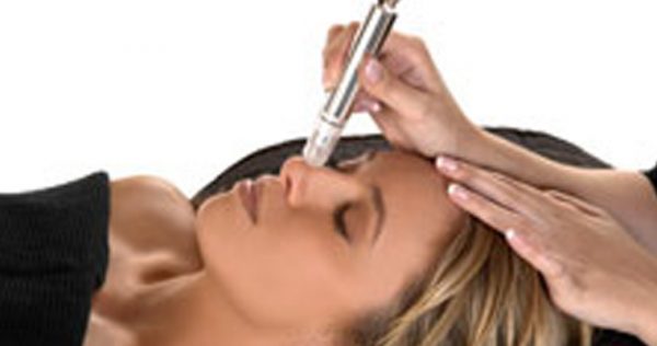 Microdermabrasion